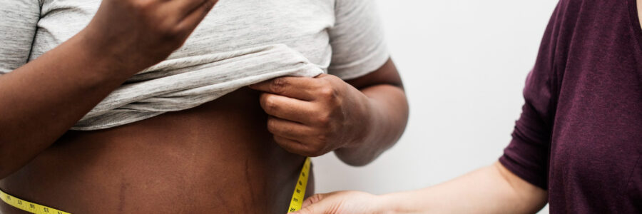 Nutrition, obésité et aliments ultra-transformés